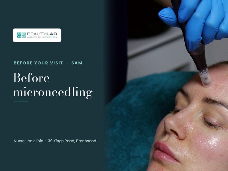 Before Microneedling: How to Prepare Your Skin and What to Expect