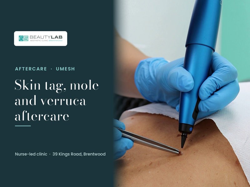 After Skin Tag, Mole or Verruca Removal: Cryotherapy Aftercare