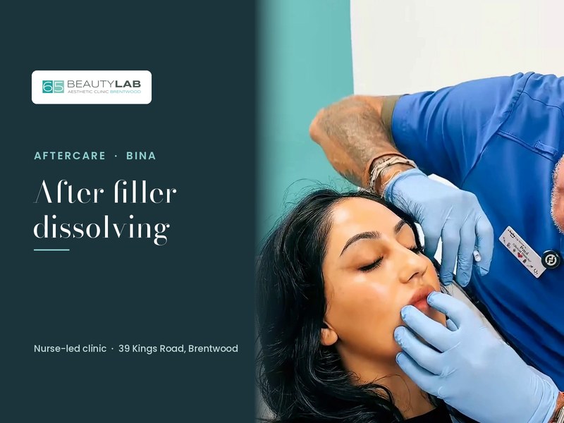 After Filler Dissolving: What's Normal and When to Worry