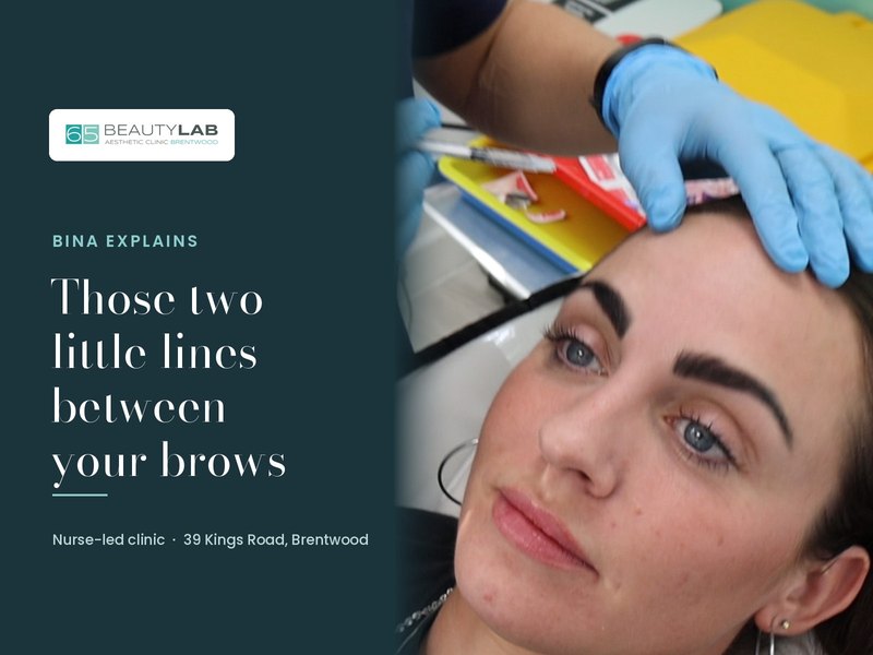 Those Two Little Lines? Bina Explains Frown Lines and Anti-Wrinkle Treatment in Brentwood