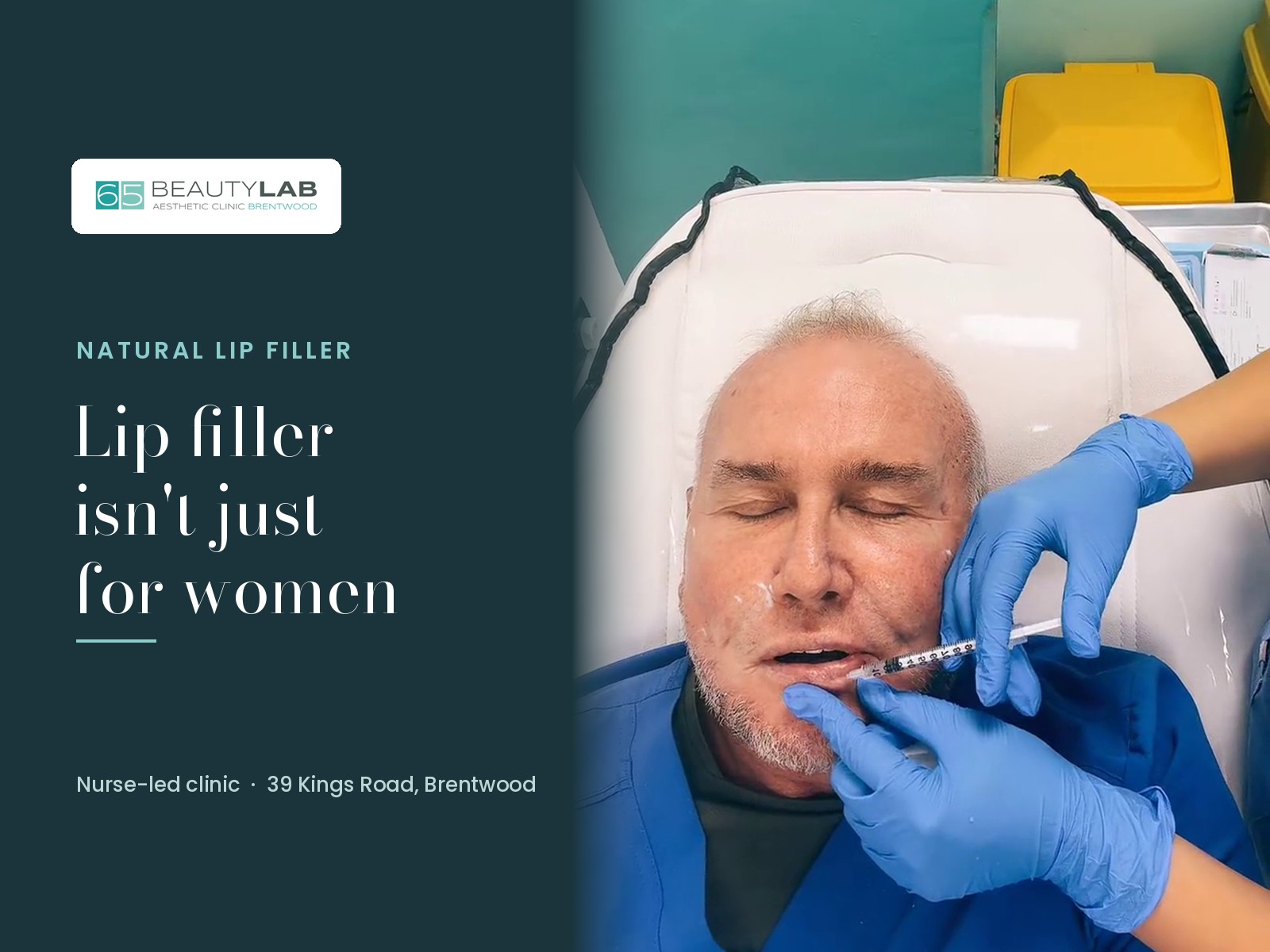 Lip Filler Isn't Just for Women: Natural Results for Men at Our Brentwood Clinic