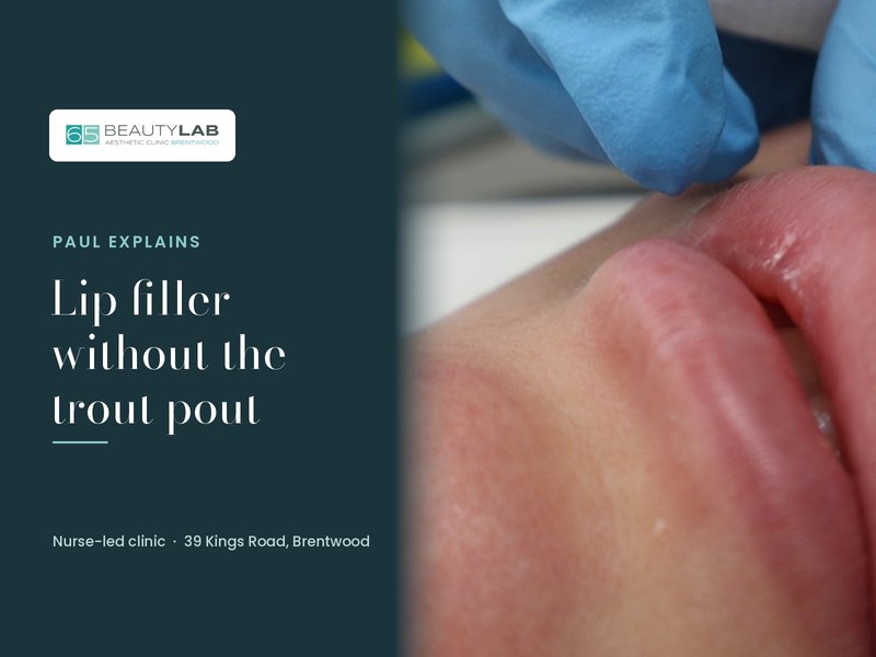 Lip Filler Without the Trout Pout: Paul Explains Our Approach in Brentwood