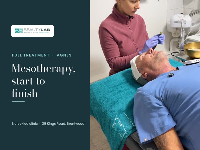 Mesotherapy Start to Finish: Watch a Real Treatment at Our Brentwood Clinic