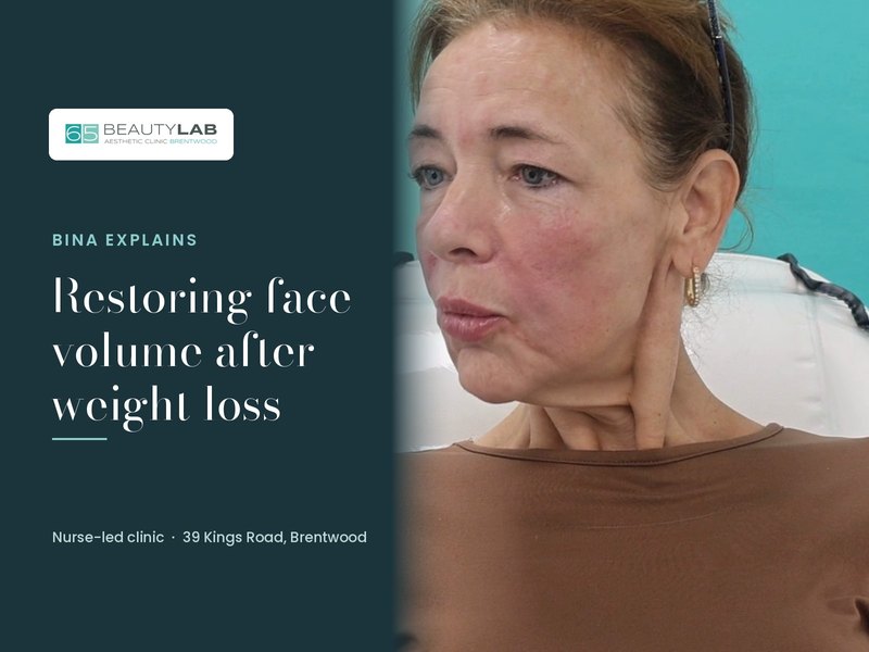 Lost 12 Stone: Restoring Facial Volume After Weight Loss at Our Brentwood Clinic
