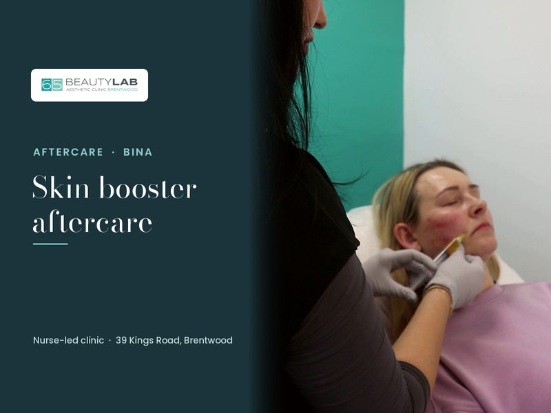 Skin Booster and Profhilo Aftercare: The Bumps, SPF and Your Course
