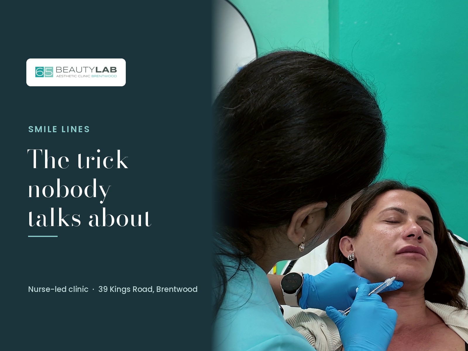 Smile Lines in Brentwood: The Technique Hardly Anyone Talks About